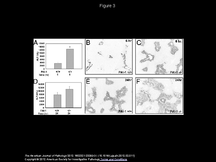 Figure 3 The American Journal of Pathology 2012 1802321 -2329 DOI: (10. 1016/j. ajpath.