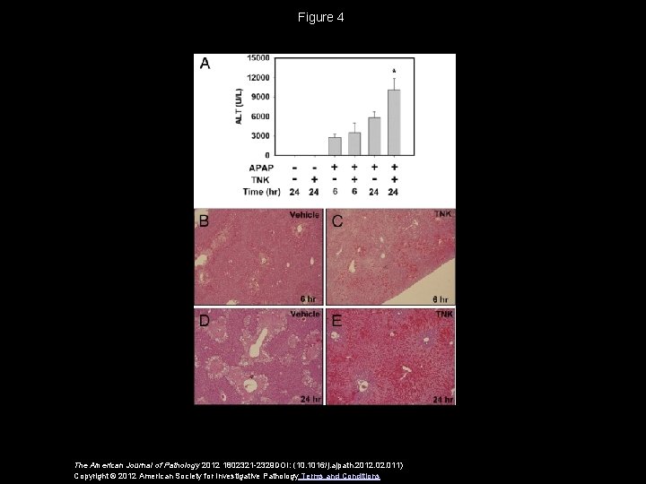 Figure 4 The American Journal of Pathology 2012 1802321 -2329 DOI: (10. 1016/j. ajpath.