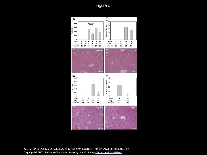 Figure 5 The American Journal of Pathology 2012 1802321 -2329 DOI: (10. 1016/j. ajpath.