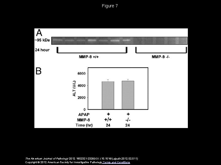 Figure 7 The American Journal of Pathology 2012 1802321 -2329 DOI: (10. 1016/j. ajpath.