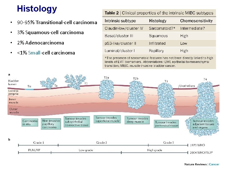 Histology • 90 -95% Transitional-cell carcinoma • 3% Squamous-cell carcinoma • 2% Adenocarcinoma •