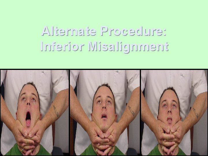 Alternate Procedure: Inferior Misalignment 