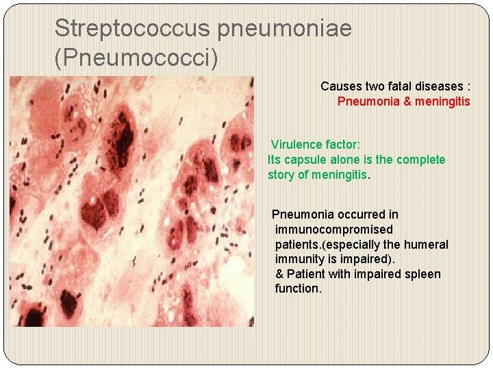 Streptococcus pneumoniae (Pneumococci) Causes two fatal diseases : Pneumonia & meningitis Virulence factor: Its