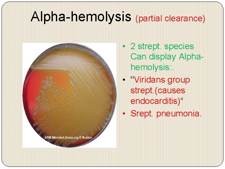 Alpha-hemolysis (partial clearance) • 2 strept. species Can display Alphahemolysis: . • "Viridans group