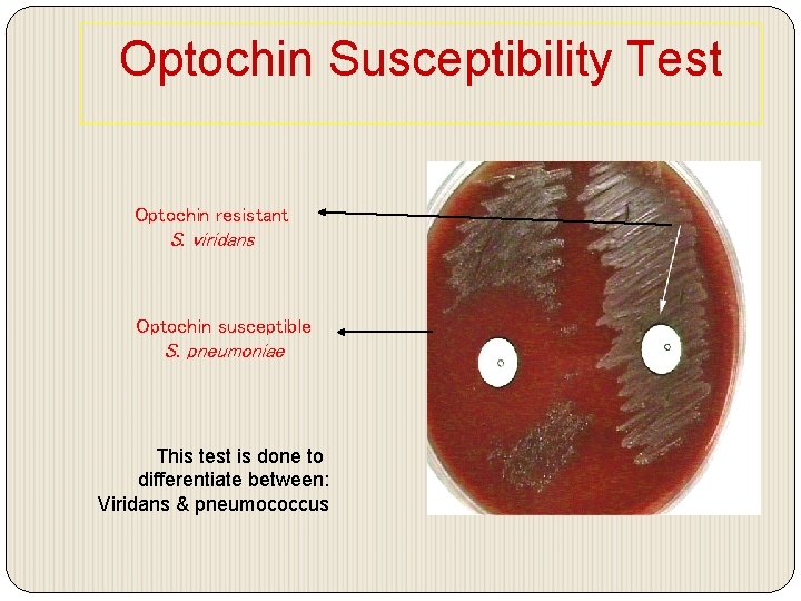 Optochin Susceptibility Test Optochin resistant S. viridans Optochin susceptible S. pneumoniae This test is