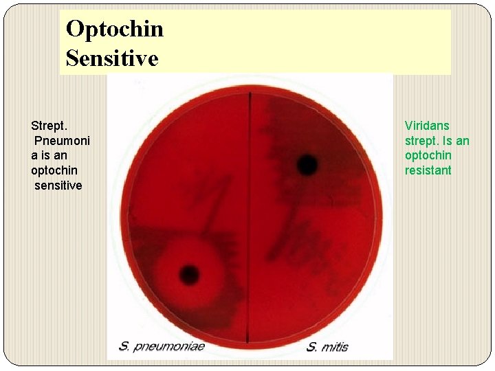 Optochin Sensitive Strept. Pneumoni a is an optochin sensitive Viridans strept. Is an optochin