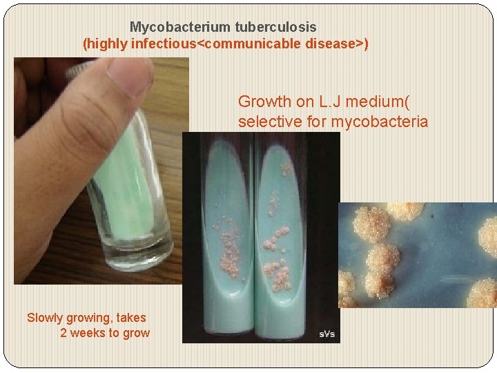 Mycobacterium tuberculosis (highly infectious<communicable disease>) Growth on L. J medium( selective for mycobacteria Slowly