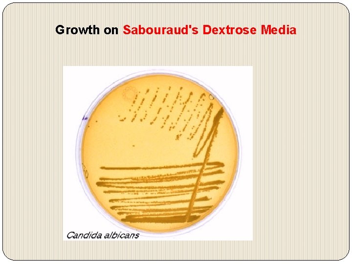 Growth on Sabouraud's Dextrose Media 