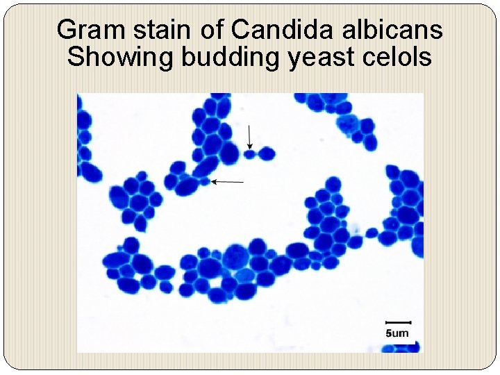 Gram stain of Candida albicans Showing budding yeast celols 