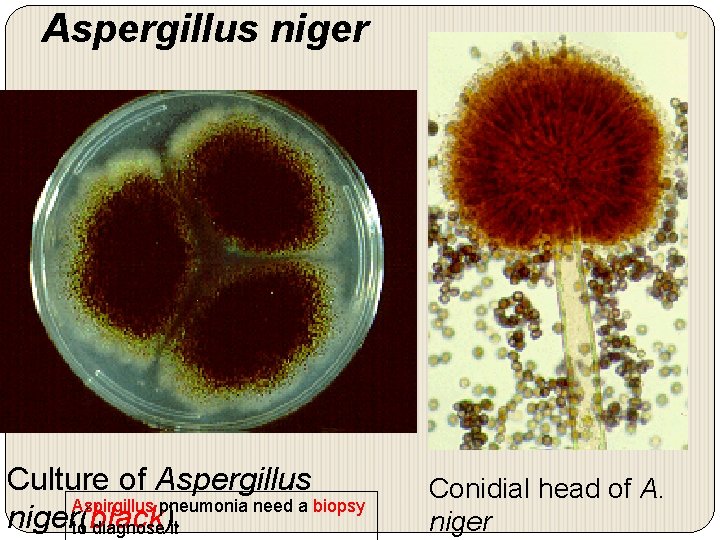 Aspergillus niger Culture of Aspergillus Aspirgillus pneumonia need a biopsy niger(black). to diagnose it