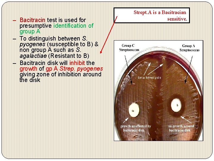 – Bacitracin test is used for presumptive identification of group A – To distinguish