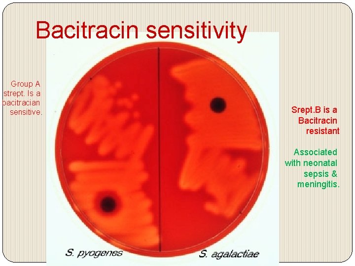 Bacitracin sensitivity Group A strept. Is a bacitracian sensitive. Srept. B is a Bacitracin