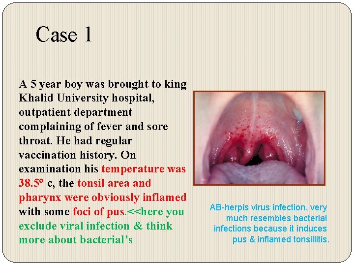 Case 1 A 5 year boy was brought to king Khalid University hospital, outpatient