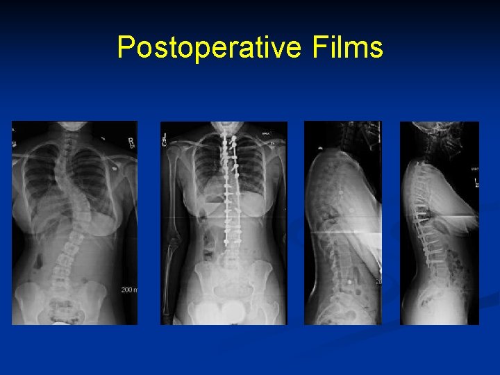 Postoperative Films 