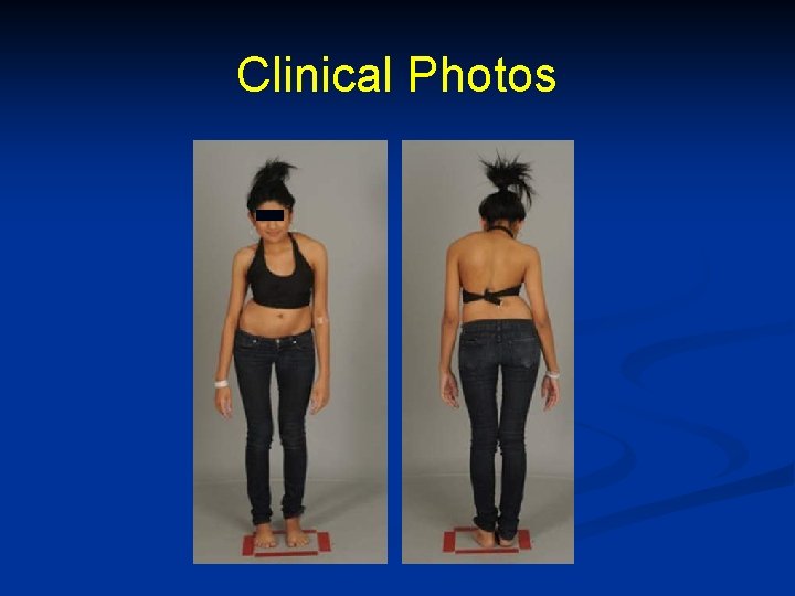 Clinical Photos 