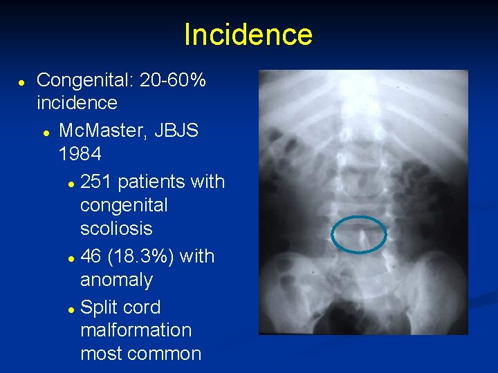 Incidence l Congenital: 20 -60% incidence l Mc. Master, JBJS 1984 l 251 patients