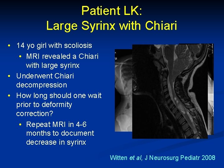 Patient LK: Large Syrinx with Chiari • 14 yo girl with scoliosis • MRI