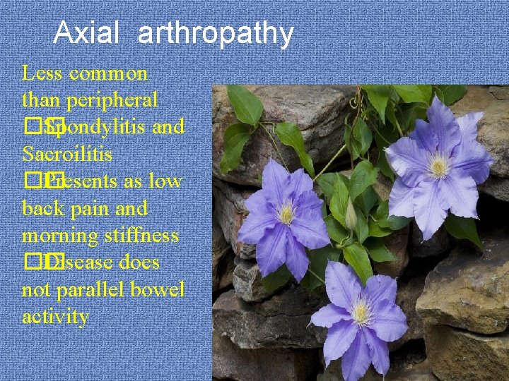 Axial arthropathy Less common than peripheral �� Spondylitis and Sacroilitis �� Presents as low