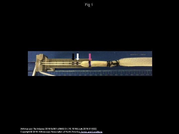 Fig 1 Arthroscopy Techniques 2016 5 e 391 -e 395 DOI: (10. 1016/j. eats.