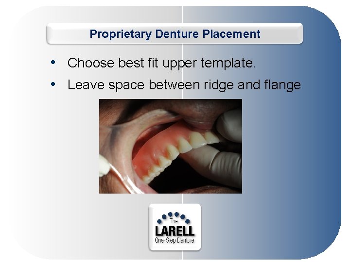 Proprietary Denture Placement • Choose best fit upper template. • Leave space between ridge