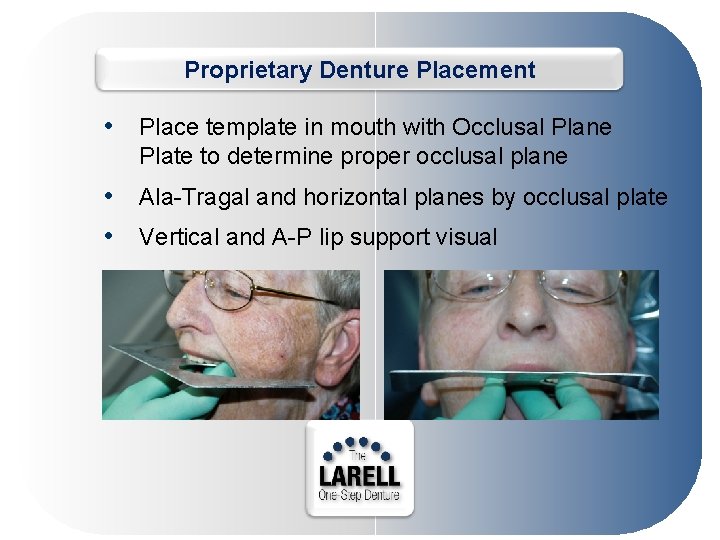 Proprietary Denture Placement • Place template in mouth with Occlusal Plane Plate to determine