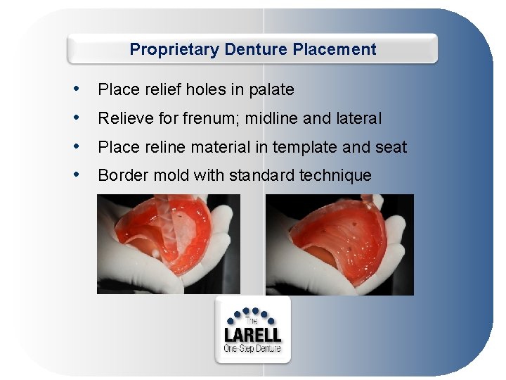 Proprietary Denture Placement • • Place relief holes in palate Relieve for frenum; midline