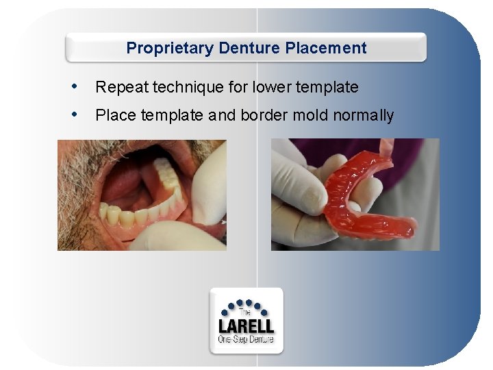 Proprietary Denture Placement • Repeat technique for lower template • Place template and border