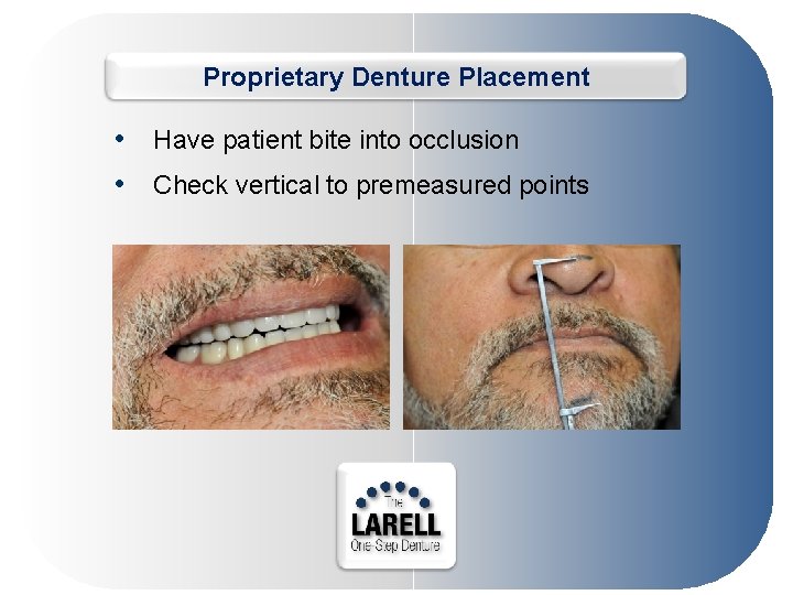Proprietary Denture Placement • Have patient bite into occlusion • Check vertical to premeasured