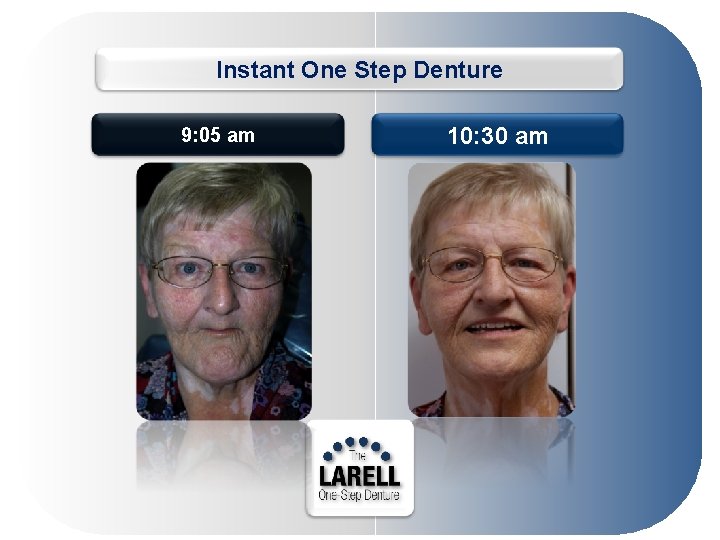 Instant One Step Denture 9: 05 am 10: 30 am 