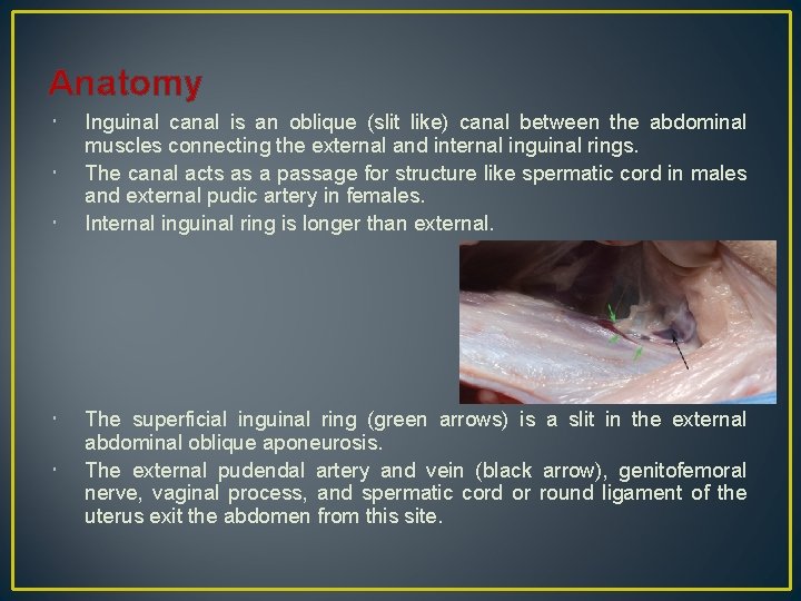 Anatomy Inguinal canal is an oblique (slit like) canal between the abdominal muscles connecting