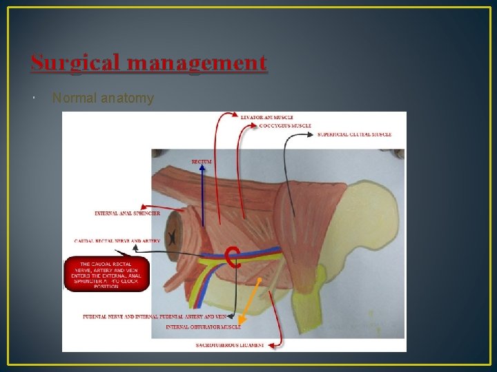 Surgical management Normal anatomy 