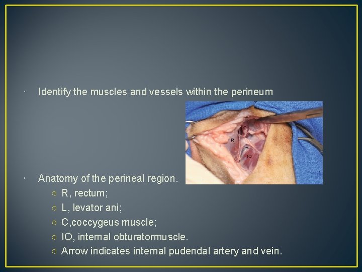  Identify the muscles and vessels within the perineum Anatomy of the perineal region.