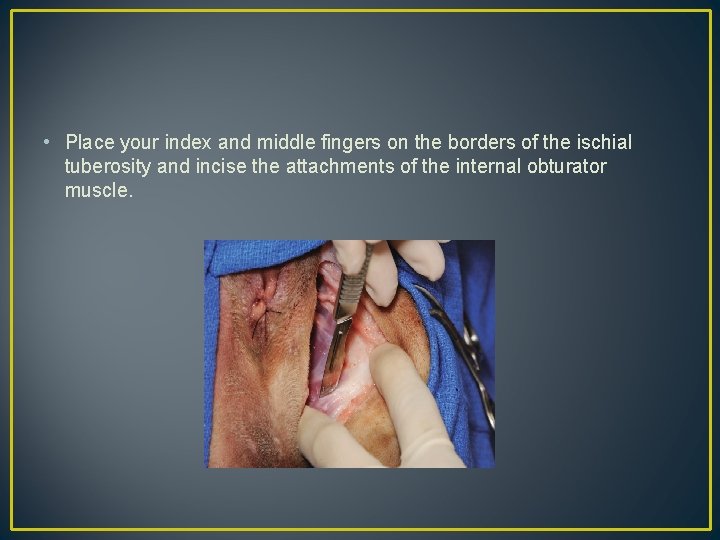  • Place your index and middle fingers on the borders of the ischial