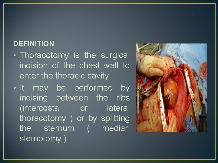 DEFINITION • Thoracotomy is the surgical incision of the chest wall to enter the