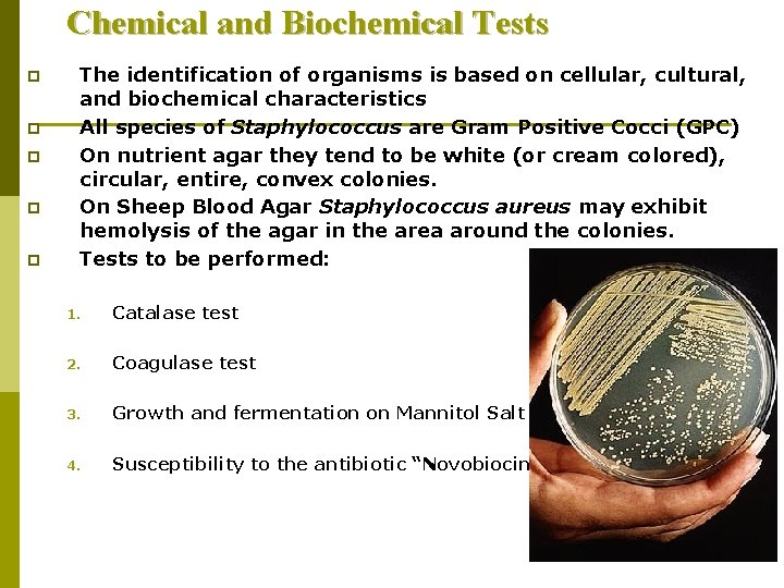 Chemical and Biochemical Tests p p p The identification of organisms is based on