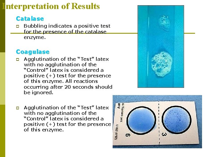 Interpretation of Results Catalase p Bubbling indicates a positive test for the presence of