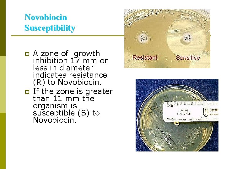 Novobiocin Susceptibility p p A zone of growth inhibition 17 mm or less in
