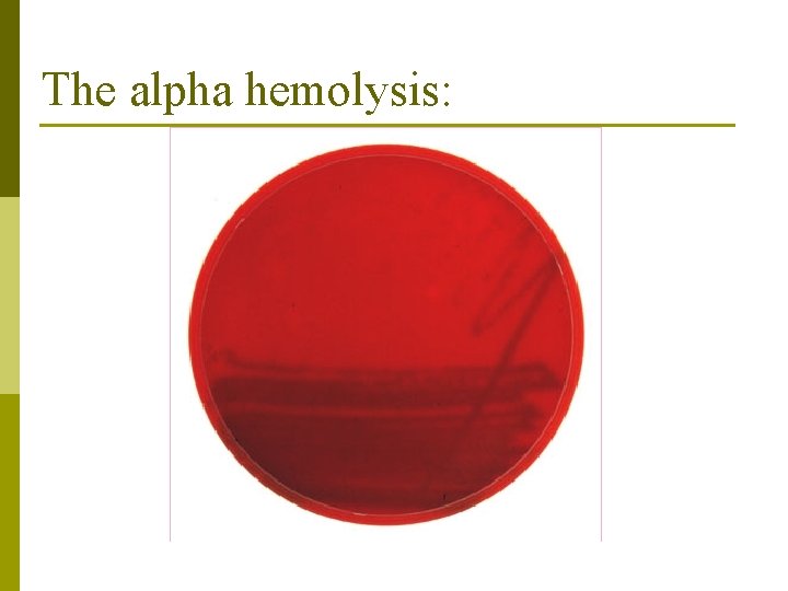 The alpha hemolysis: 