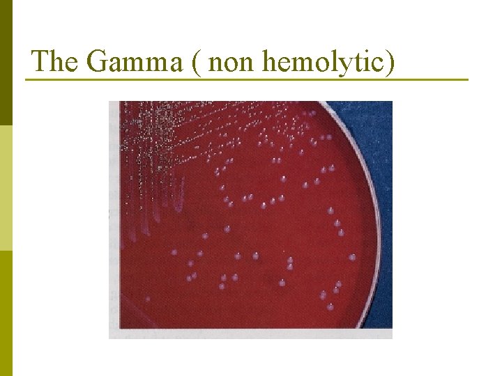 The Gamma ( non hemolytic) 