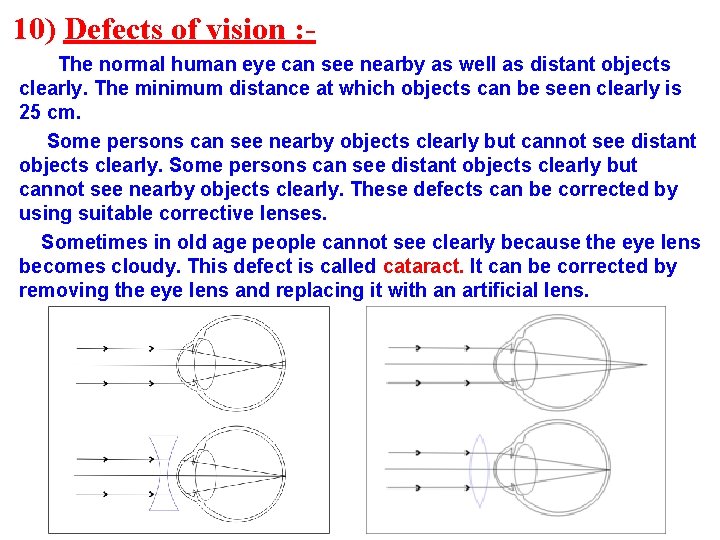 10) Defects of vision : The normal human eye can see nearby as well