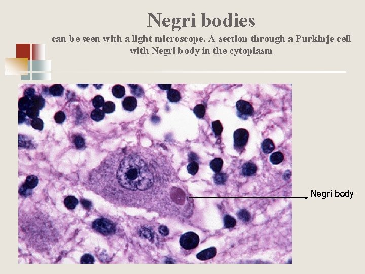 Negri bodies can be seen with a light microscope. A section through a Purkinje