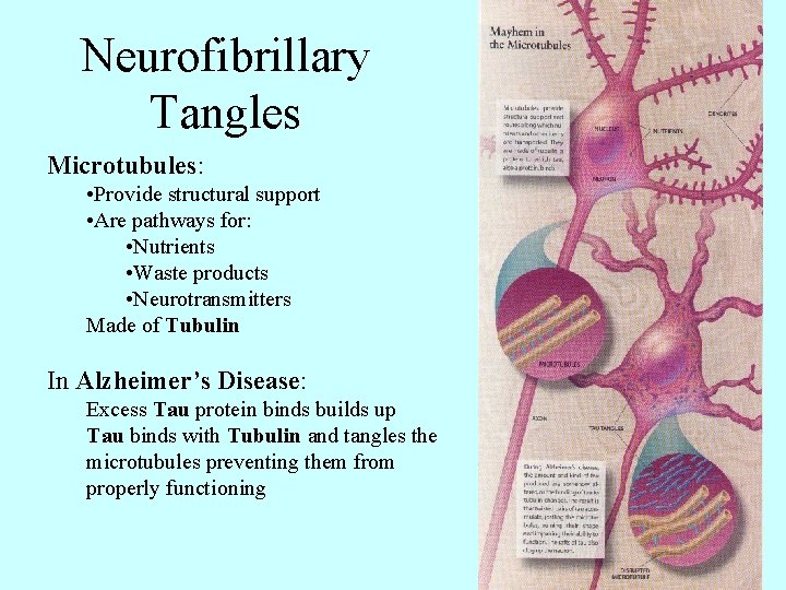 Neurofibrillary Tangles Microtubules: • Provide structural support • Are pathways for: • Nutrients •
