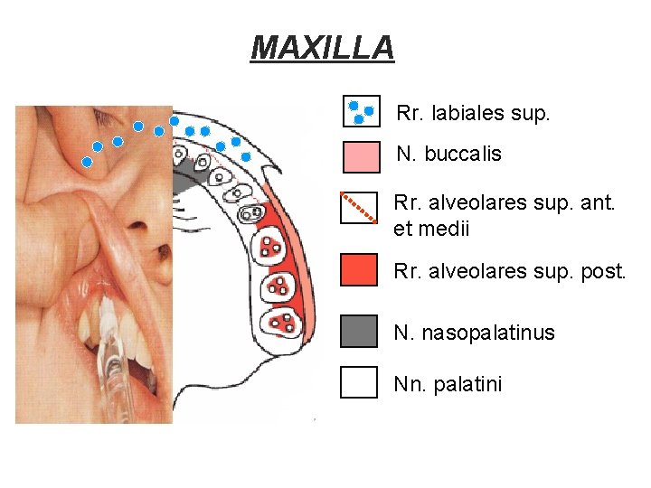 MAXILLA Rr. labiales sup. N. buccalis Rr. alveolares sup. ant. et medii Rr. alveolares