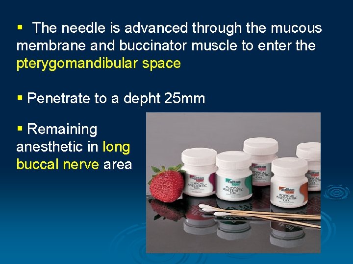 § The needle is advanced through the mucous membrane and buccinator muscle to enter