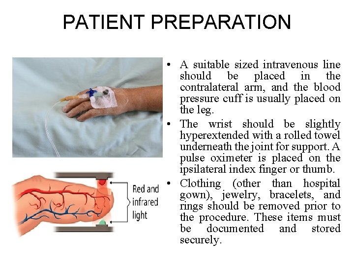 PATIENT PREPARATION • A suitable sized intravenous line should be placed in the contralateral PATIENT PREPARATION • A suitable sized intravenous line should be placed in the contralateral