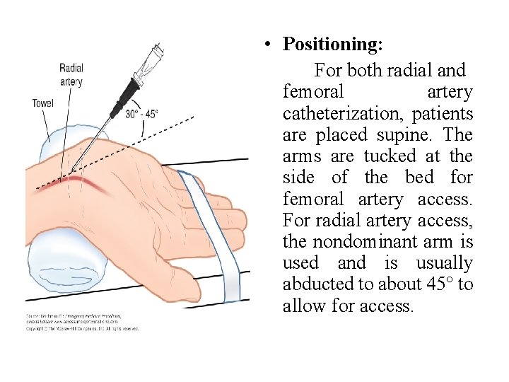 • Positioning: For both radial and femoral artery catheterization, patients are placed supine. • Positioning: For both radial and femoral artery catheterization, patients are placed supine.