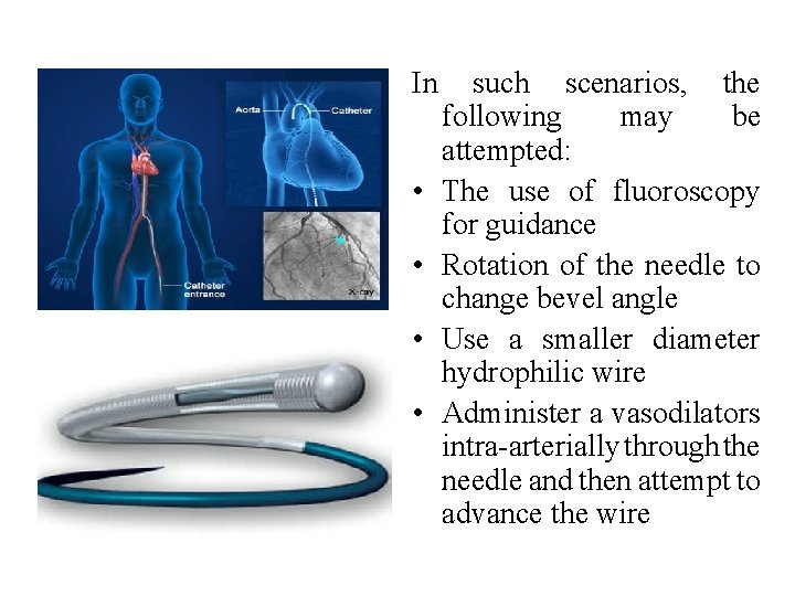 In such scenarios, the following may be attempted: • The use of fluoroscopy for In such scenarios, the following may be attempted: • The use of fluoroscopy for