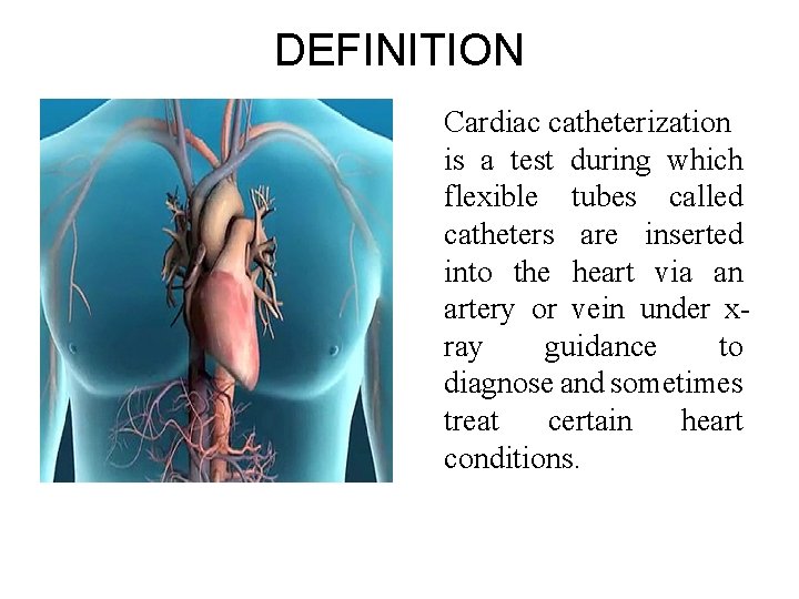 DEFINITION Cardiac catheterization is a test during which flexible tubes called catheters are inserted DEFINITION Cardiac catheterization is a test during which flexible tubes called catheters are inserted