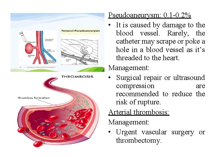 Pseudoaneurysm: 0. 1 -0. 2% • It is caused by damage to the blood Pseudoaneurysm: 0. 1 -0. 2% • It is caused by damage to the blood