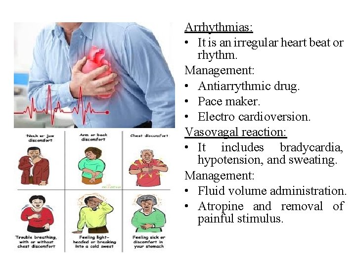 Arrhythmias: • It is an irregular heart beat or rhythm. Management: • Antiarrythmic drug. Arrhythmias: • It is an irregular heart beat or rhythm. Management: • Antiarrythmic drug.